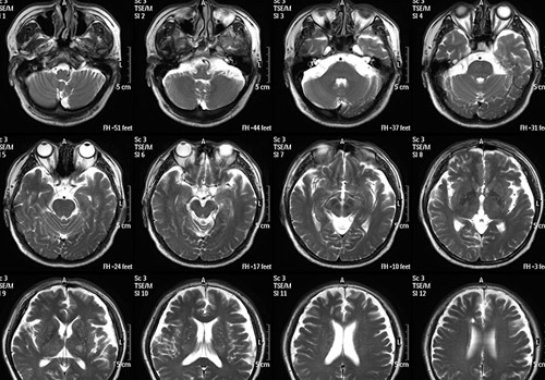 14X17MRI 2